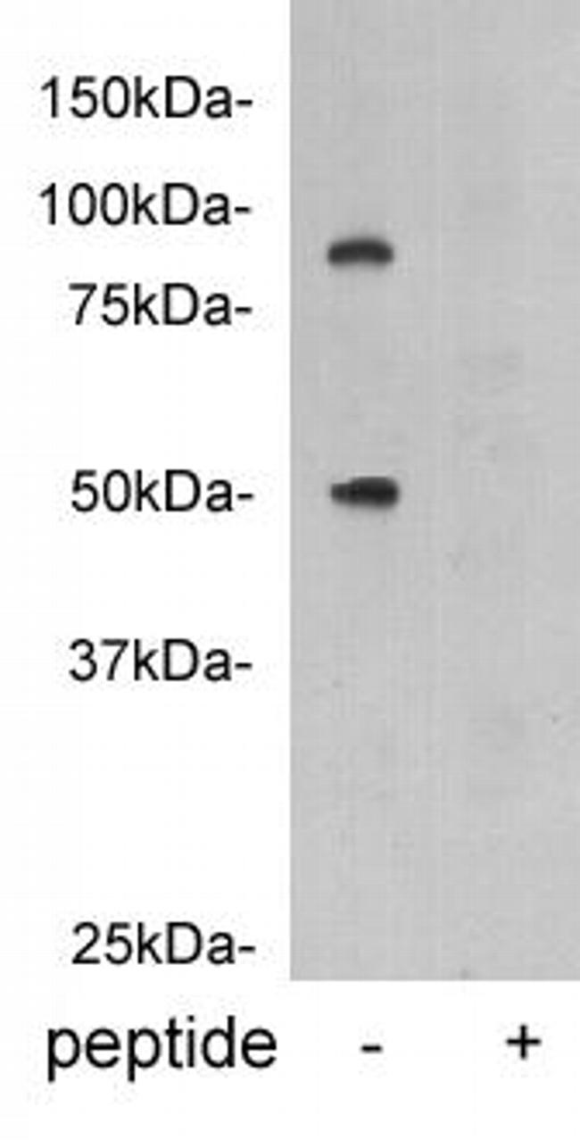 Protein C Antibody in Western Blot (WB)