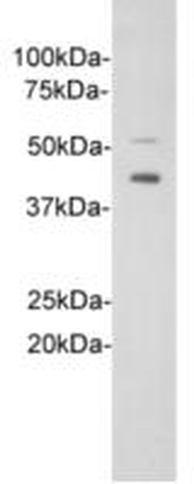 ST2 Antibody in Western Blot (WB)