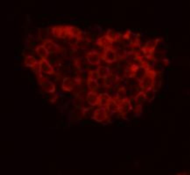 FAT4 Antibody in Immunocytochemistry (ICC/IF)