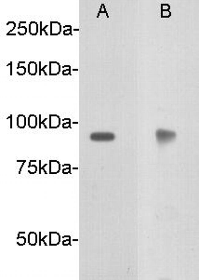 DCC Antibody in Western Blot (WB)