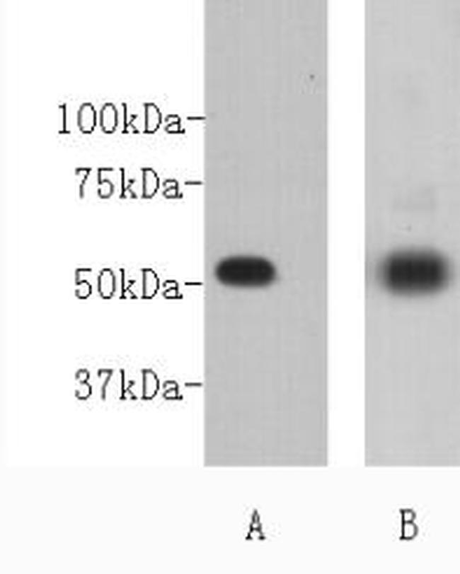 CD271 (NGF Receptor) Antibody in Western Blot (WB)