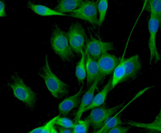 CD80 (B7-1) Antibody in Immunocytochemistry (ICC/IF)