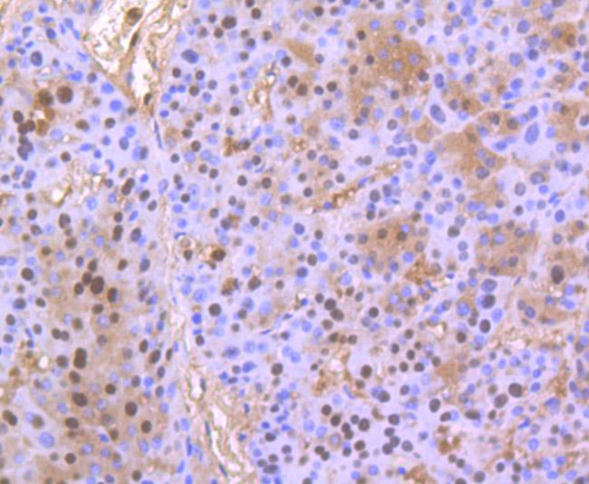 PHF10 Antibody in Immunohistochemistry (Paraffin) (IHC (P))