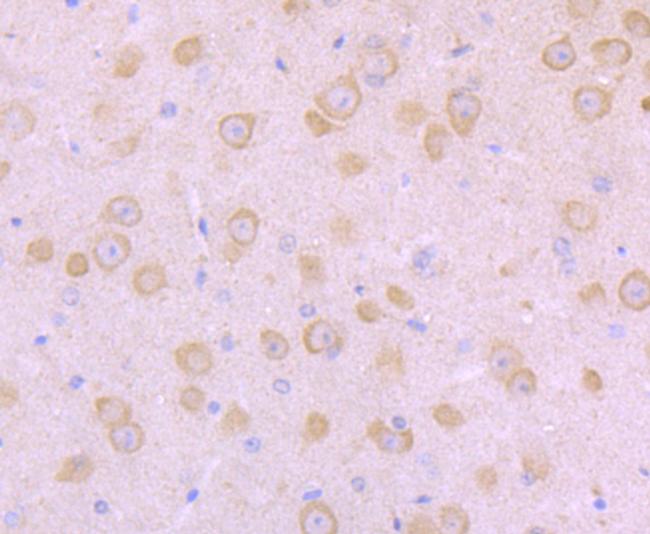 SCN10A Antibody in Immunohistochemistry (Paraffin) (IHC (P))