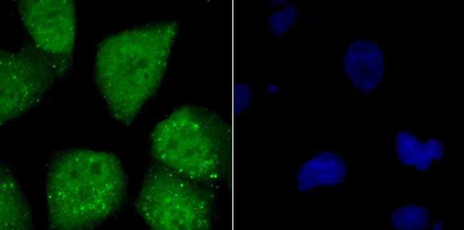 ATF6 Antibody in Immunocytochemistry (ICC/IF)