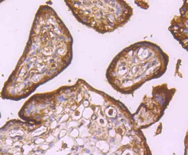 CD71 (Transferrin Receptor) Antibody in Immunohistochemistry (Paraffin) (IHC (P))