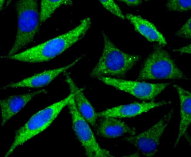 PPM1A Antibody in Immunocytochemistry (ICC/IF)