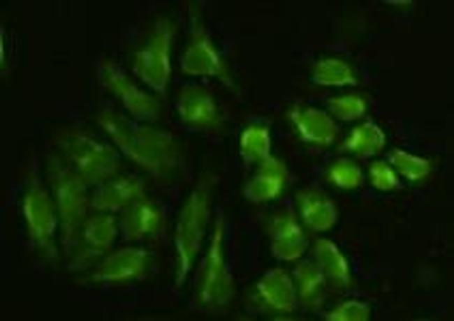 Vimentin Antibody in Immunocytochemistry (ICC/IF)