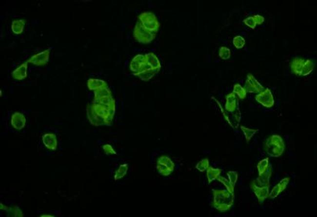 Beta III Tubulin Antibody in Immunocytochemistry (ICC/IF)