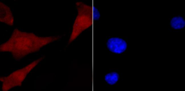 CUG-BP2 Antibody in Immunocytochemistry (ICC/IF)