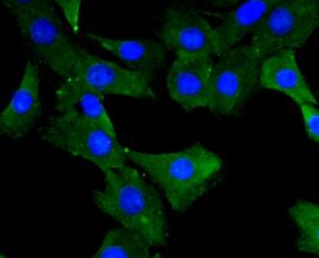 MYLK Antibody in Immunocytochemistry (ICC/IF)