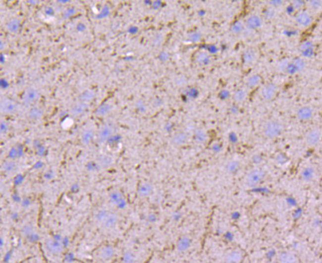 Nestin Antibody in Immunohistochemistry (Paraffin) (IHC (P))