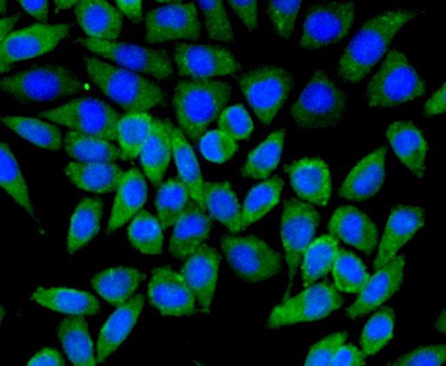 TSC2 Antibody in Immunocytochemistry (ICC/IF)