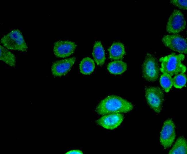 SIRT3 Antibody in Immunocytochemistry (ICC/IF)