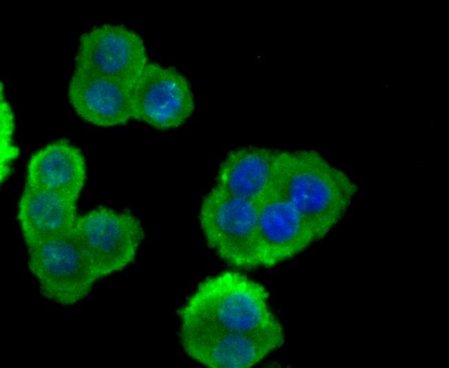 ESD Antibody in Immunocytochemistry (ICC/IF)