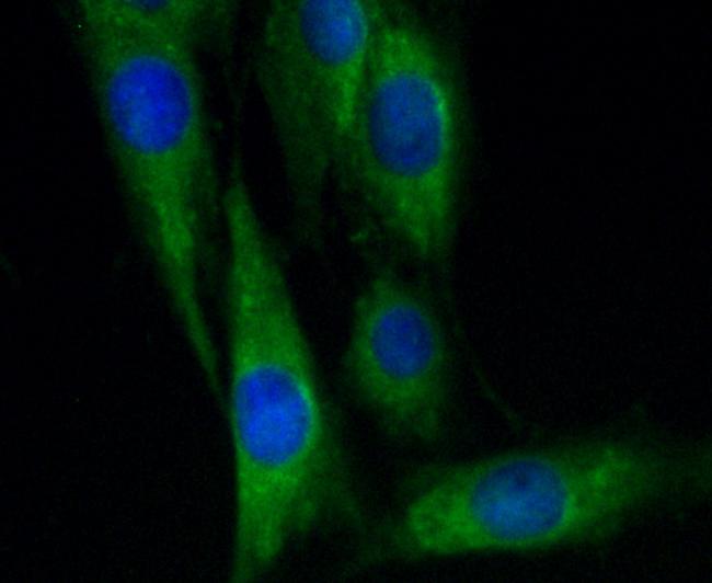 VCAM-1 (CD106) Antibody in Immunocytochemistry (ICC/IF)