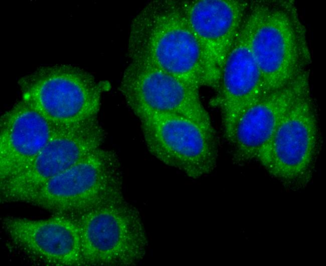 Cathepsin D Antibody in Immunocytochemistry (ICC/IF)