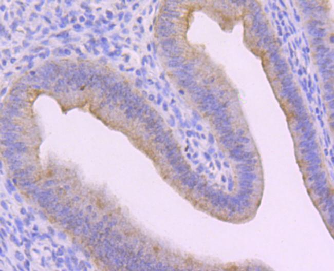 Cytokeratin 13 Antibody in Immunohistochemistry (Paraffin) (IHC (P))