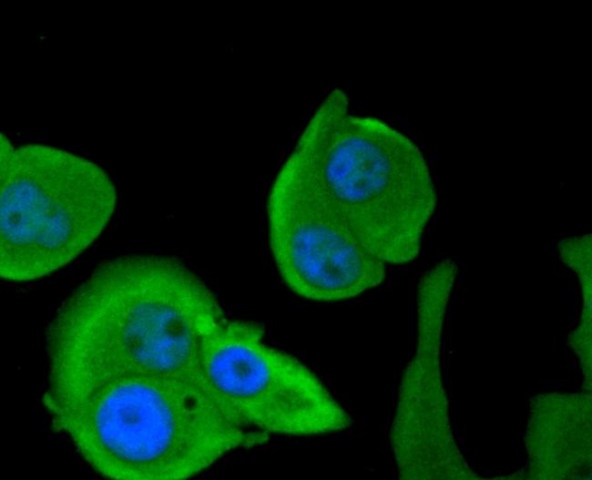 Calpain 1 Antibody in Immunocytochemistry (ICC/IF)