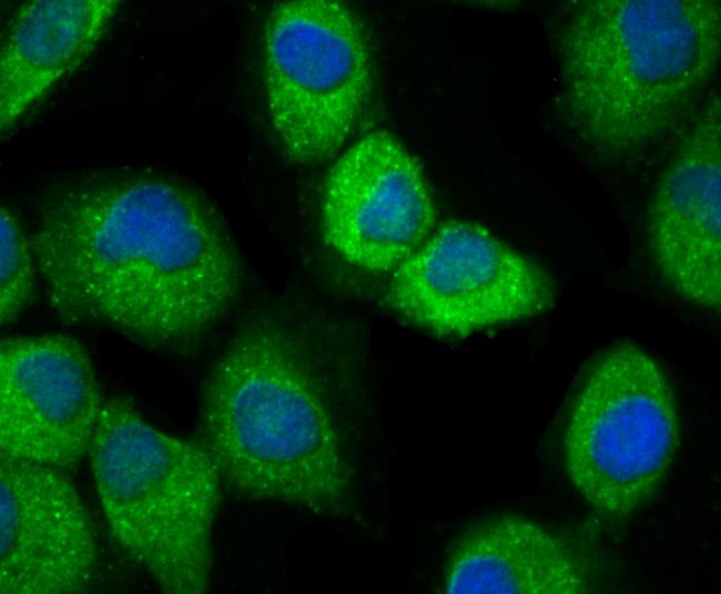 IKK beta Antibody in Immunocytochemistry (ICC/IF)