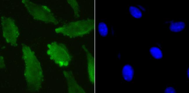 UBA3 Antibody in Immunocytochemistry (ICC/IF)