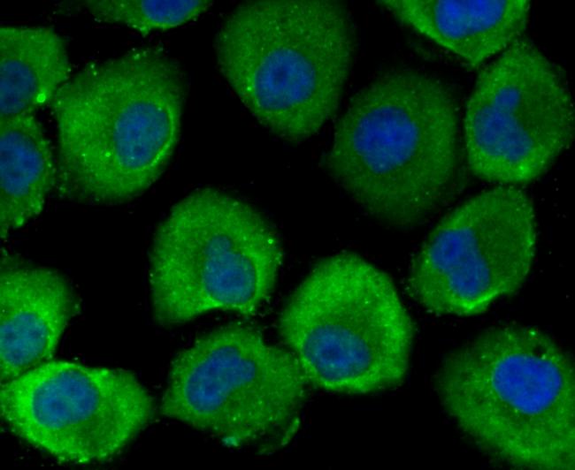 Bax Antibody in Immunocytochemistry (ICC/IF)