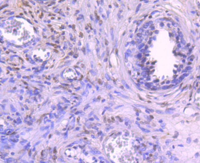 NFIB Antibody in Immunohistochemistry (Paraffin) (IHC (P))