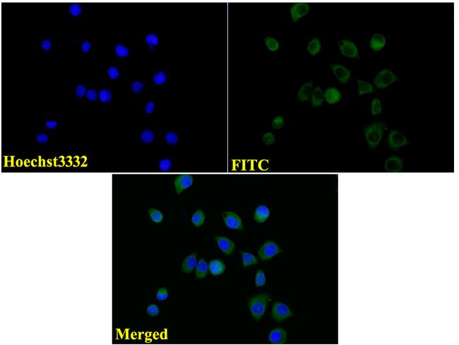 beta-3 Tubulin Antibody in Immunocytochemistry (ICC/IF)