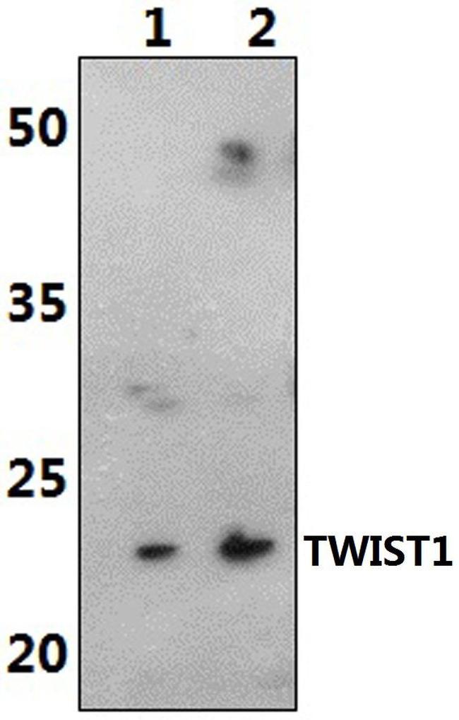 TWIST1 Antibody in Western Blot (WB)