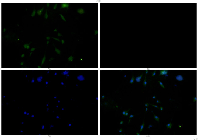 STAT3 Antibody in Immunocytochemistry (ICC/IF)