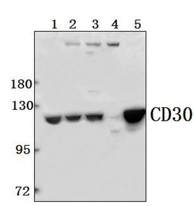 CD30 Antibody in Western Blot (WB)