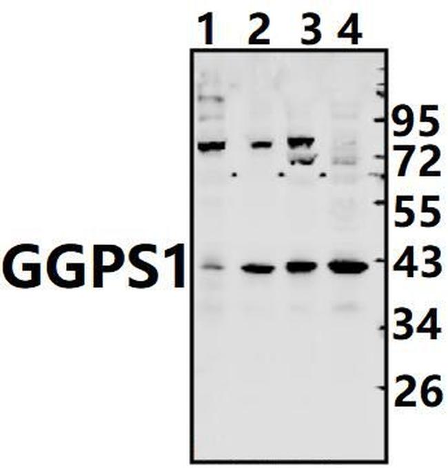 GGPS1 Antibody in Western Blot (WB)