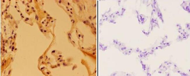 APAF1 Antibody in Immunohistochemistry (Paraffin) (IHC (P))