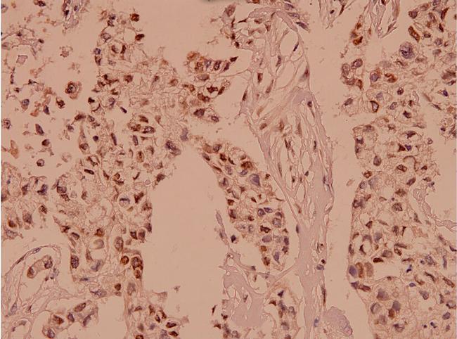 Protein APC Antibody in Immunohistochemistry (Paraffin) (IHC (P))