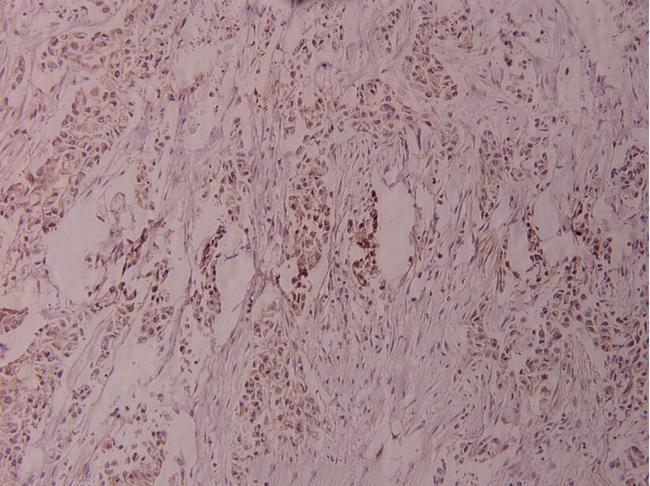 ATF2 Antibody in Immunohistochemistry (Paraffin) (IHC (P))