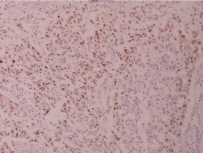 ATF2 Antibody in Immunohistochemistry (Paraffin) (IHC (P))