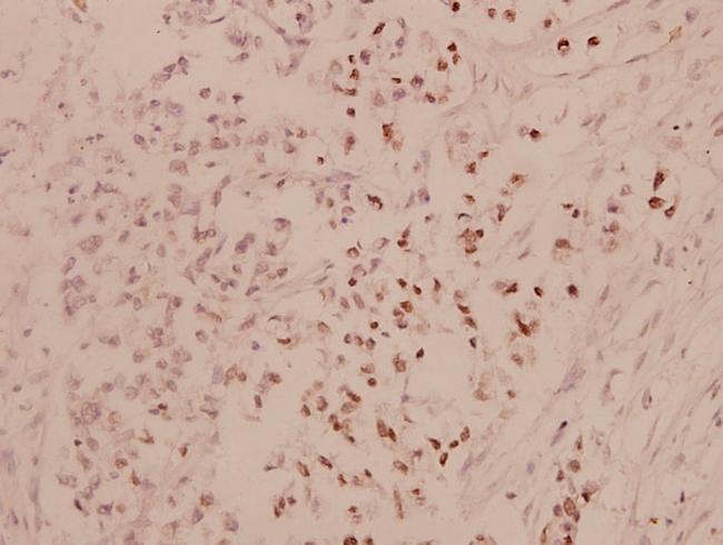 ATF4 Antibody in Immunohistochemistry (Paraffin) (IHC (P))