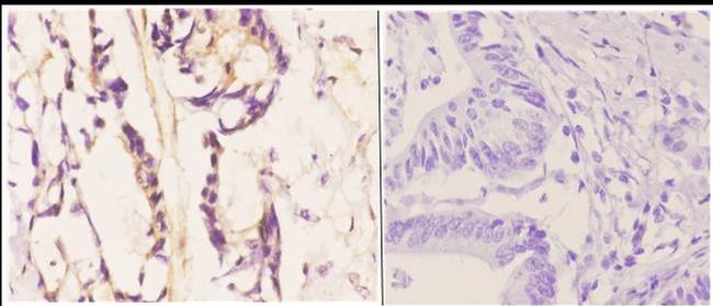 Bim Antibody in Immunohistochemistry (Paraffin) (IHC (P))