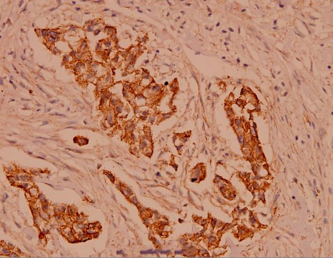 gamma Catenin Antibody in Immunohistochemistry (Paraffin) (IHC (P))