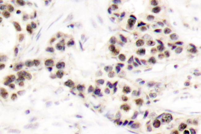 CHK2 Antibody in Immunohistochemistry (Paraffin) (IHC (P))