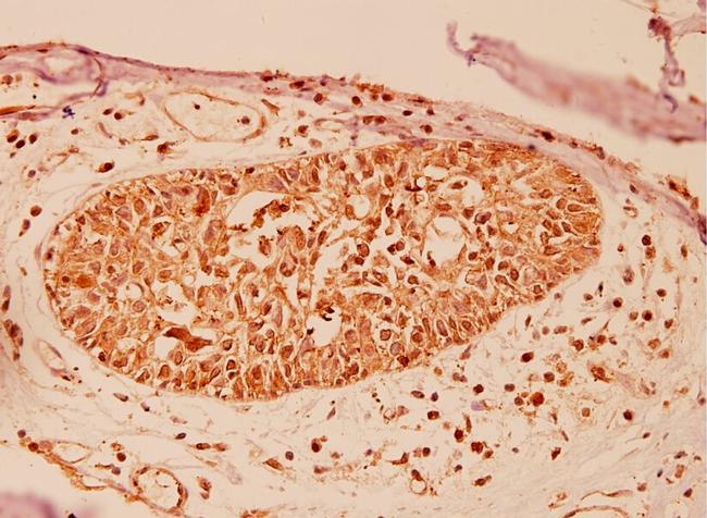 DJ-1 Antibody in Immunohistochemistry (Paraffin) (IHC (P))