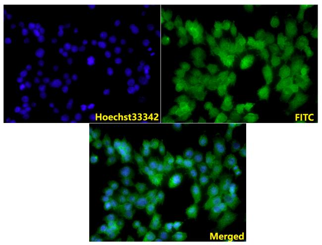 Filamin A Antibody in Immunocytochemistry (ICC/IF)