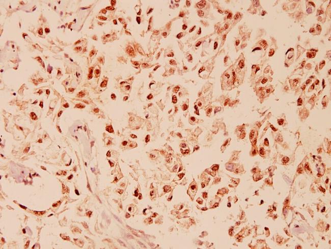 CHOP Antibody in Immunohistochemistry (Paraffin) (IHC (P))