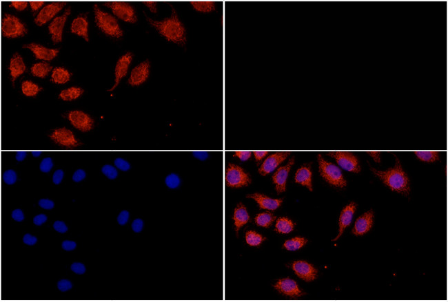 Galectin 3 Antibody in Immunocytochemistry (ICC/IF)