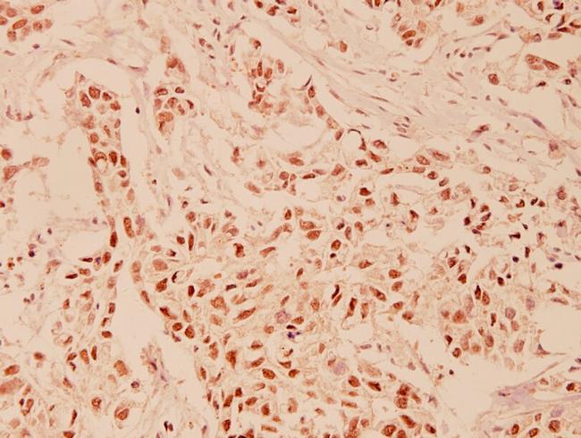 HDAC6 Antibody in Immunohistochemistry (Paraffin) (IHC (P))