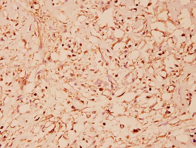 HSP60 Antibody in Immunohistochemistry (Paraffin) (IHC (P))