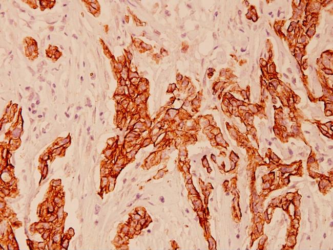 Cytokeratin 8 Antibody in Immunohistochemistry (Paraffin) (IHC (P))