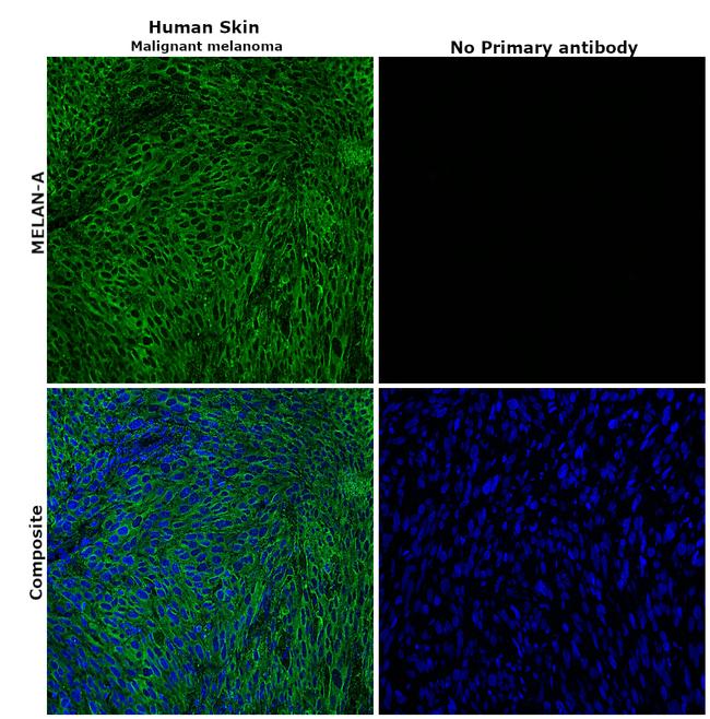 Melan-A Antibody in Immunohistochemistry (Paraffin) (IHC (P))