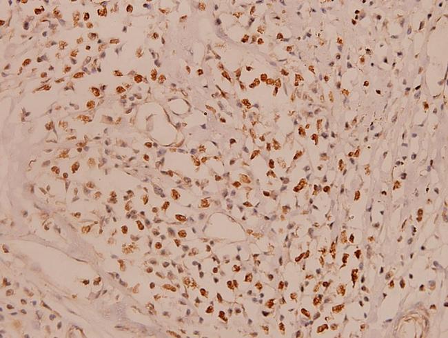 MCL-1 Antibody in Immunohistochemistry (Paraffin) (IHC (P))