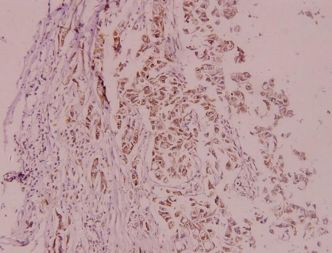 MDM2 Antibody in Immunohistochemistry (Paraffin) (IHC (P))